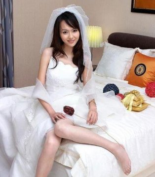 慢性前列腺炎